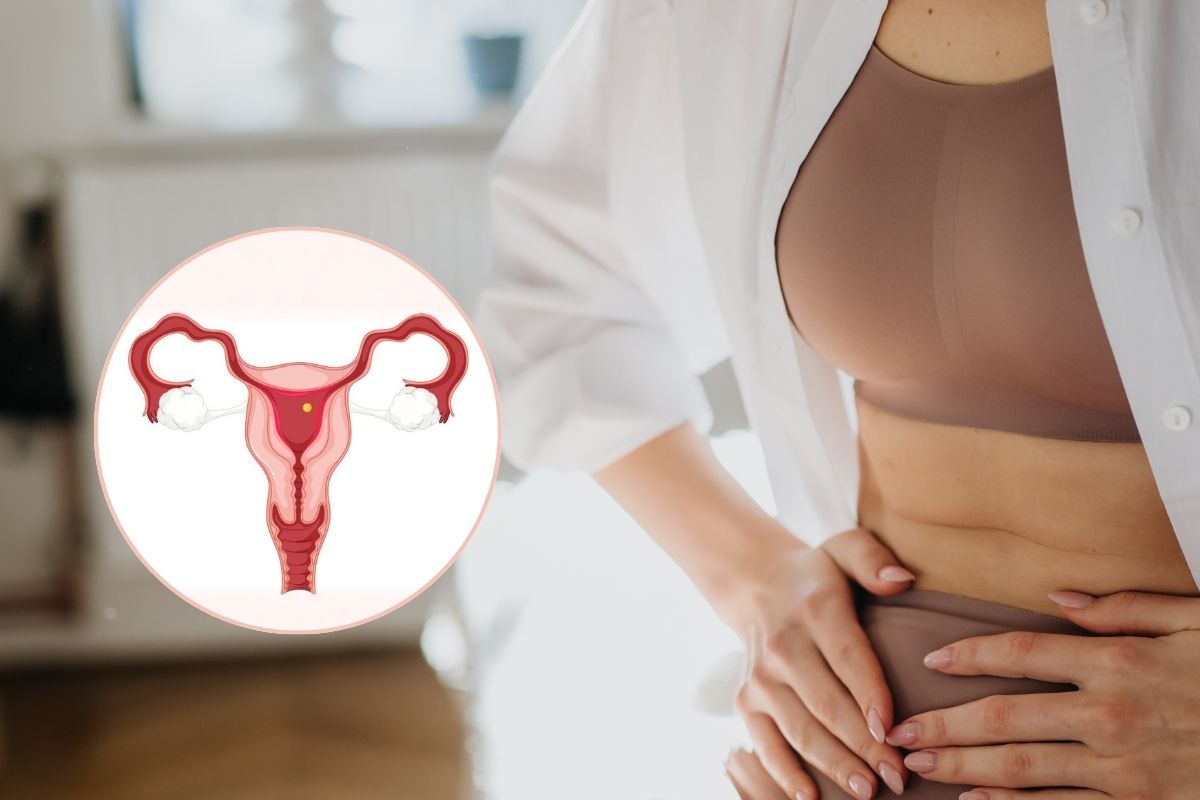 Why Do Couples Choose IVF